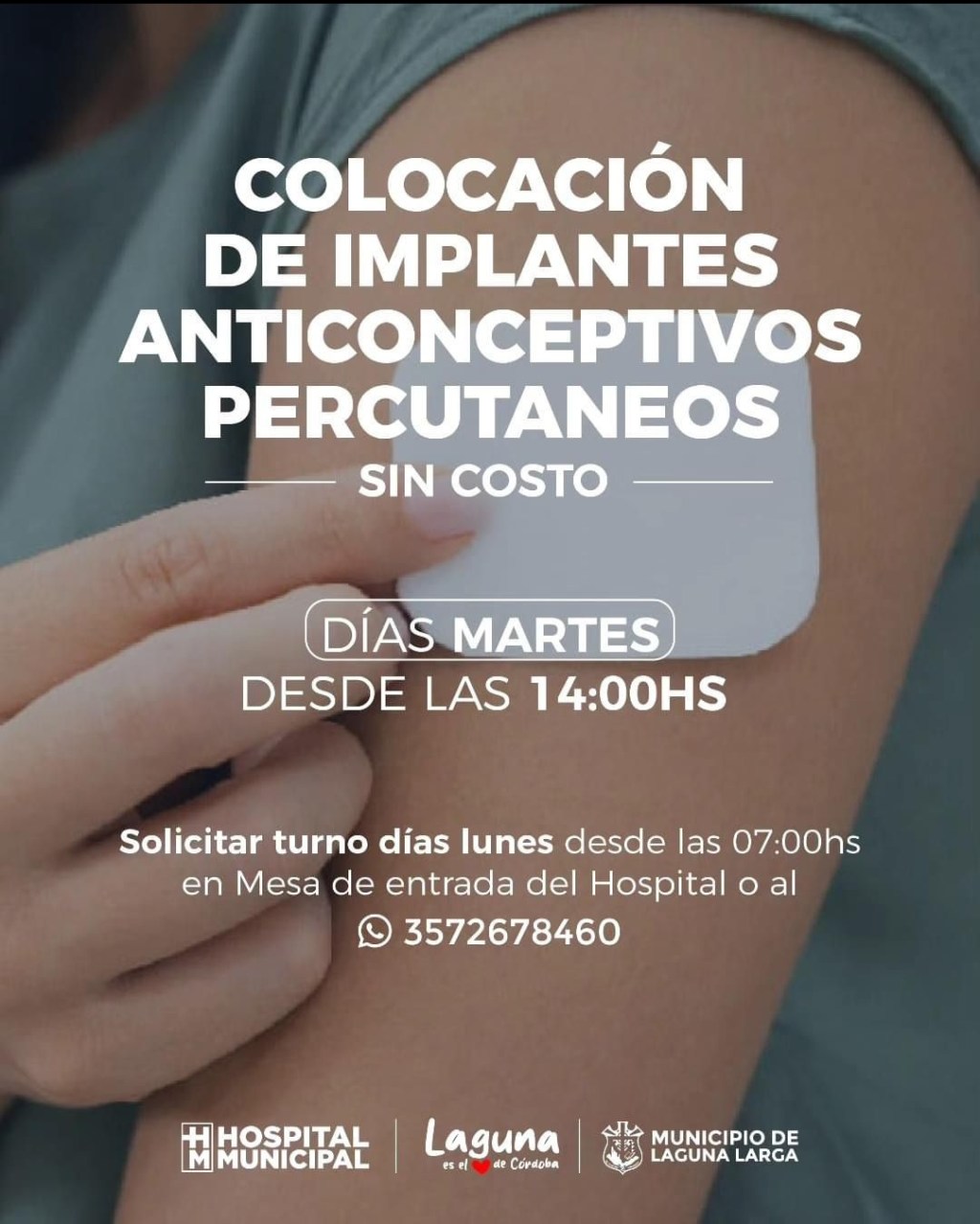Colocación de Implantes Anticonceptivos&nbsp;Percutaneos